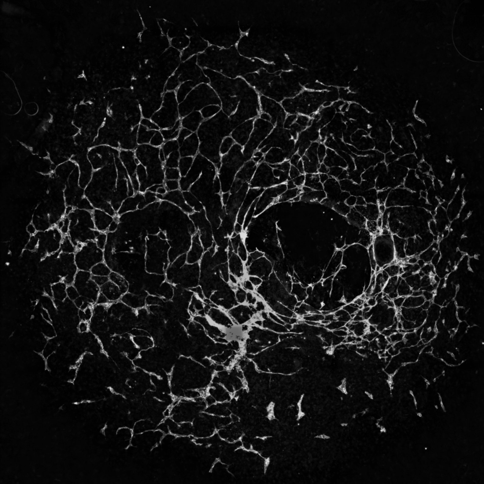 El espíritu de la angiogénesis